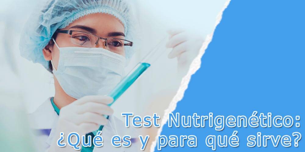 Test nutrigenético