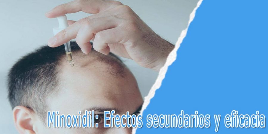 Minoxidil: Efectos secundarios y eficacia 1 Minoxidil: Efectos secundarios y eficacia