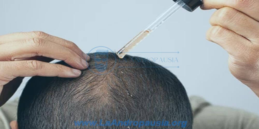 ¿Qué es el minoxidil?