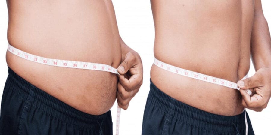 Manga gástrica vs bypass gástrico: diferencias, ventajas y resultados 3 Comparativa - manga gástrica vs bypass gástrico