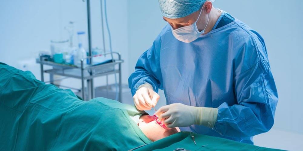 Implante de prótesis peniana