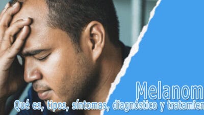 Melanoma - qué es, tipos, síntomas, diagnóstico y tratamiento
