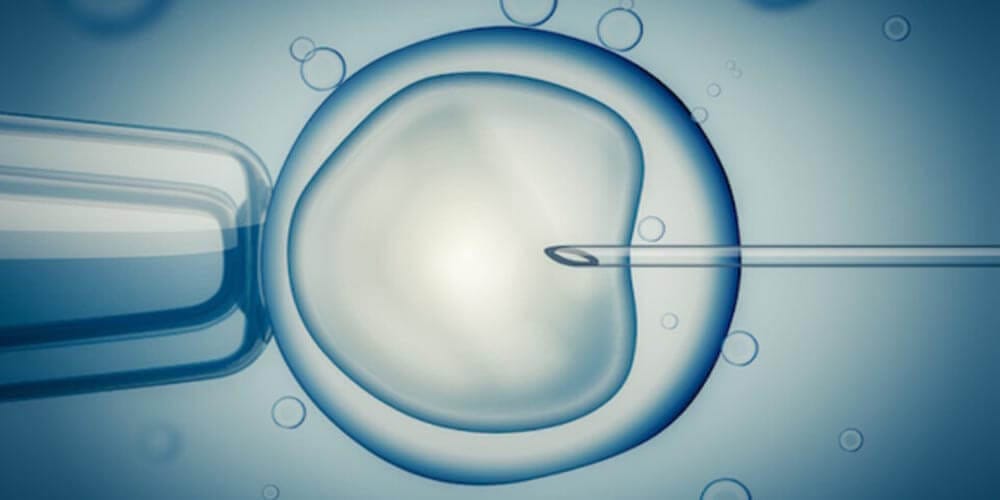Qué es la fecundación in vitro (FIV)