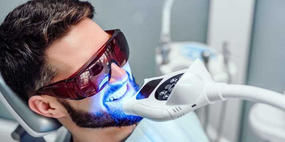 Tipos de blanqueamiento dental